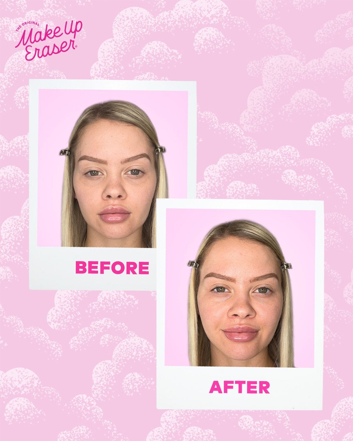Cooling Clouds® Reusable Undereye Patches | 2024 Allure Award Winner
